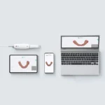 Woodpecker Smile Scan – Ağız İçi Tarayıcı (3D Görüntüleme Çözümleri) ürün görseli