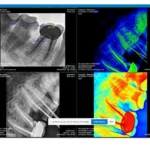 Xpect Vision RVG SİZE 1 ürün görseli