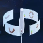 Woodpecker Smile Scan – Ağız İçi Tarayıcı (3D Görüntüleme Çözümleri) ürün görseli