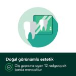 Kompozit restorasyon estetik sonuç görseli